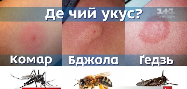 Як розпізнати небезпечний укус комахи і правильно на нього зреагувати -  поради дерматолога - YouTube